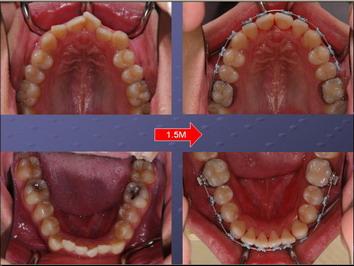 余宗坤醫師|齒顎矯正科|我的文章|個人主頁|KingNet國家網路醫藥