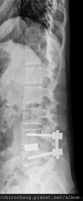 張軒彬物理治療師|骨科|我的文章|個人主頁|KingNet國家網路醫藥