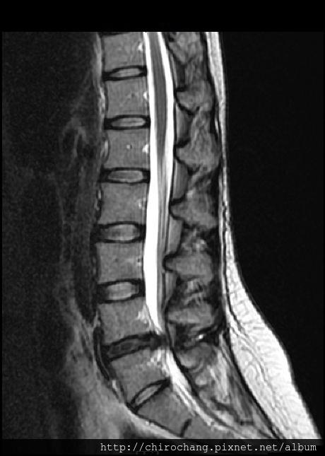 張軒彬物理治療師|骨科|我的文章|個人主頁|KingNet國家網路醫藥