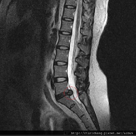張軒彬物理治療師|骨科|我的文章|個人主頁|KingNet國家網路醫藥