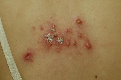 李承鴻醫師|皮膚科|我的文章|個人主頁|KingNet國家網路醫藥