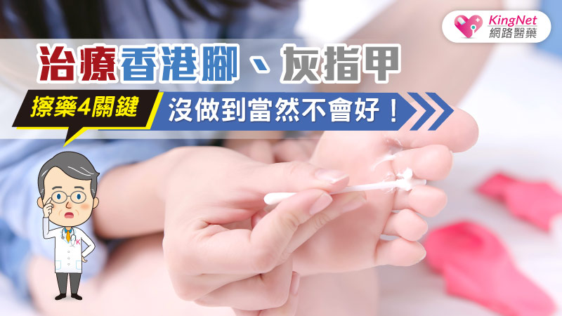 治療香港腳、灰指甲，擦藥4關鍵沒做到當然不會好！_圖1