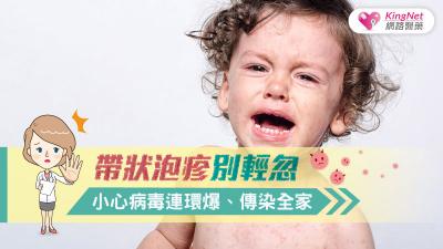 帶狀泡疹別輕忽，小心病毒連環爆、傳染全家！