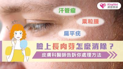 臉上長肉芽怎麼消除？汗管瘤、粟粒腫、扁平疣，皮膚科醫師告訴你處理方法