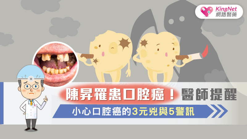 陳昇罹患口腔癌！醫師提醒，小心口腔癌的3元兇與5警訊_圖1