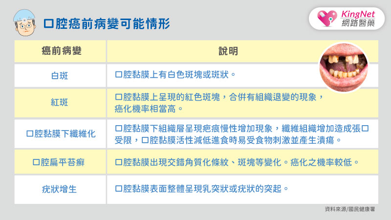 陳昇罹患口腔癌！醫師提醒，小心口腔癌的3元兇與5警訊_圖2