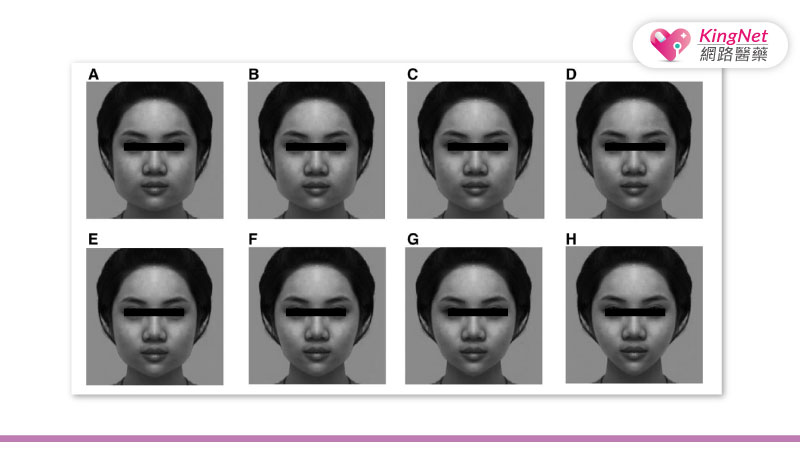 依據90%、87%、85%、83%、80%、75%、70%、65%，修改成8種不同收斂度臉形。