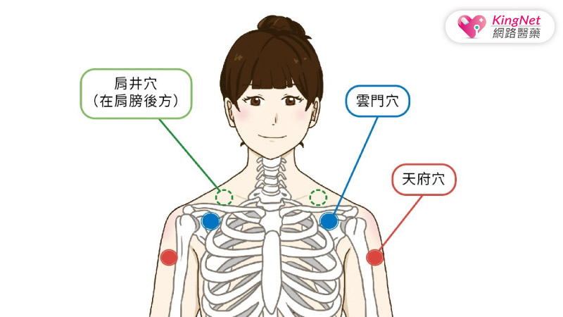 不打網球也會網球肘？專家傳授止痛2招_圖3