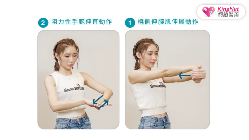 不打網球也會網球肘？專家傳授止痛2招_圖4