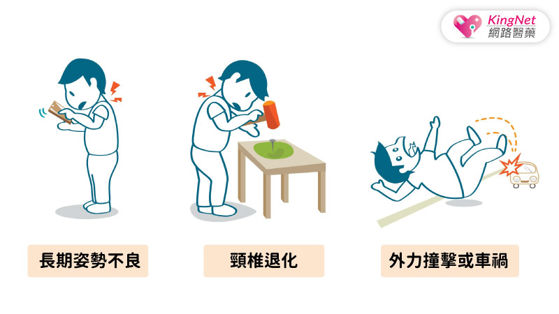 頸椎出狀況，身體都百病！專家傳授頸椎病止痛3招_圖2