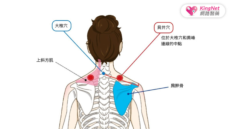 頸椎出狀況，身體都百病！專家傳授頸椎病止痛3招_圖3