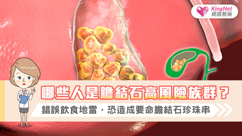 哪些人是膽結石高風險族群？錯誤飲食地雷，恐造成要命膽結石珍珠串_圖1