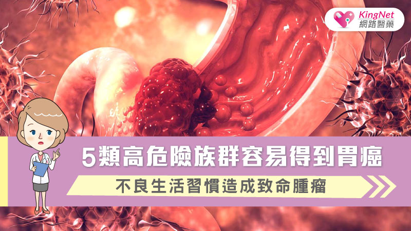 5類高危險族群容易得到胃癌  不良生活習慣造成致命腫瘤_圖1