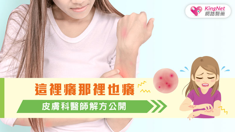 夏季皮膚癢怎麼辦？皮膚科醫師1妙招止癢_圖1