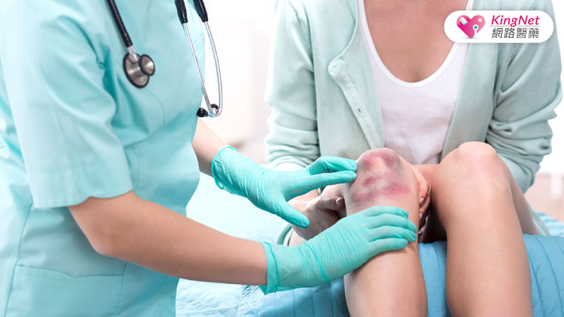 血小板低下胃癌