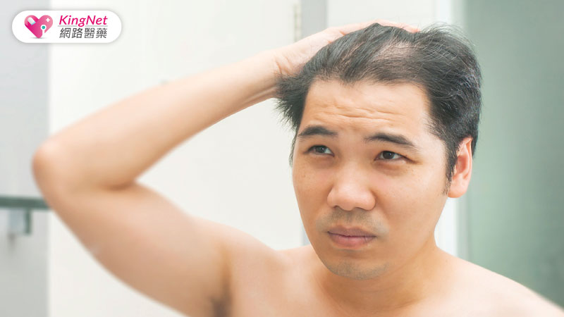 新冠後遺症掉髮