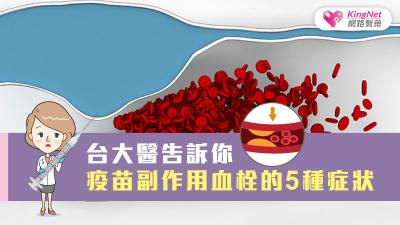 台大醫告訴你 疫苗副作用血栓的5種症狀