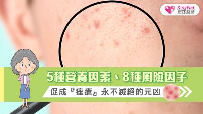 5種營養因素、8種風險因子，促成『痤瘡』永不滅絕的元凶！