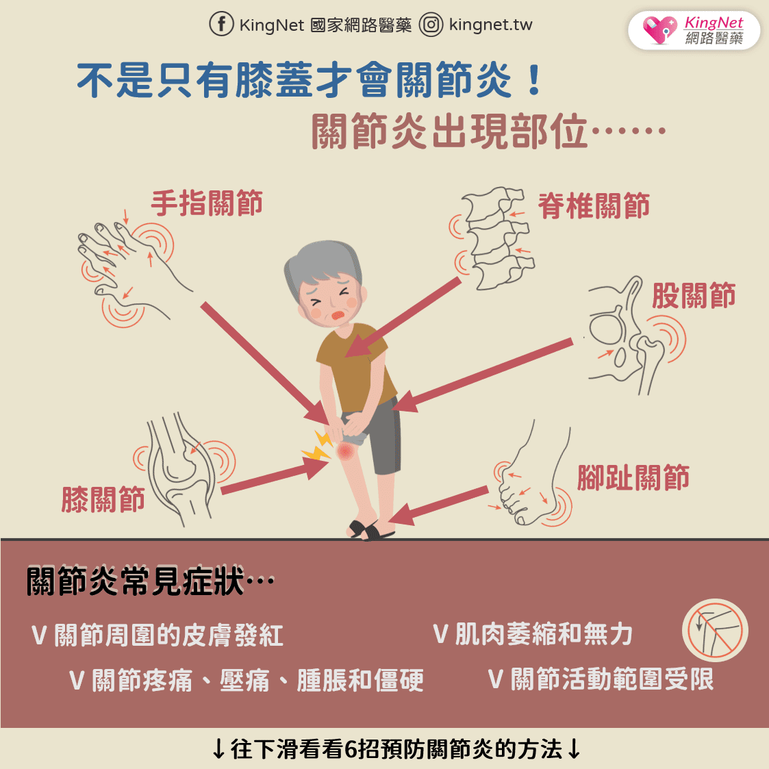 關節炎發生部位