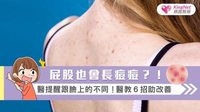 屁股也會長痘痘？！醫提醒跟臉上的不同！醫教６招助改善
