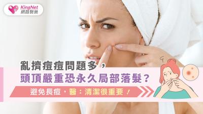 亂擠痘痘問題多，頭頂嚴重恐永久局部落髮？避免長痘，醫：清潔很重要！