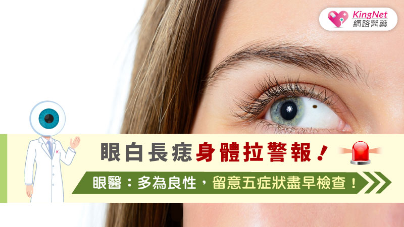 眼白長痣身體拉警報！眼醫：多為良性，留意五症狀盡早檢查！
