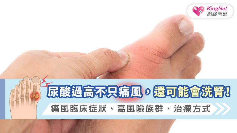 尿酸過高不只痛風，還可能會洗腎！痛風臨床症狀、高風險族群、治療方式_圖1