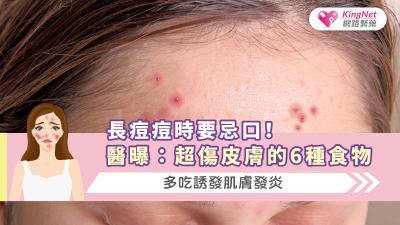 長痘痘時要忌口！醫曝：超傷皮膚的6種食物，多吃誘發肌膚發炎