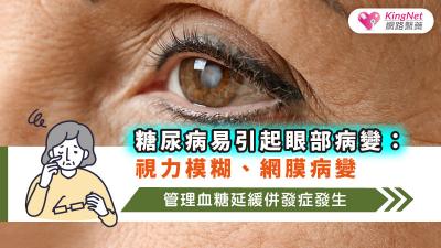糖尿病易引起眼部病變：視力模糊、網膜病變，管理血糖延緩併發症發生
