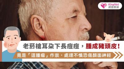 老菸槍耳朵下長痘痘，腫成豬頭皮！竟是「這腫瘤」作祟，處理不慎恐傷顏面神經