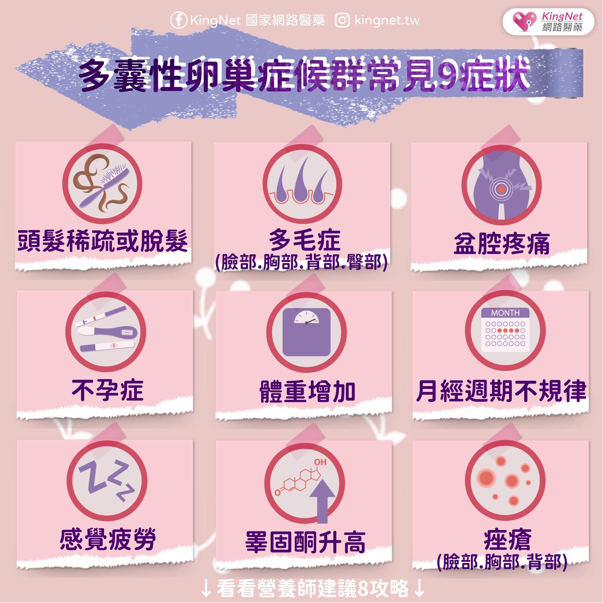 多囊性卵巢症候群症狀