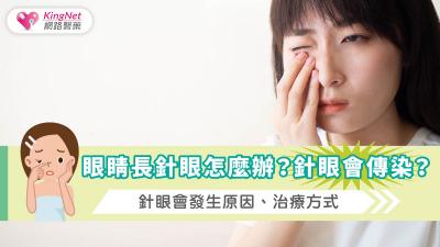 眼睛長針眼怎麼辦？針眼會傳染？針眼會發生原因、治療方式