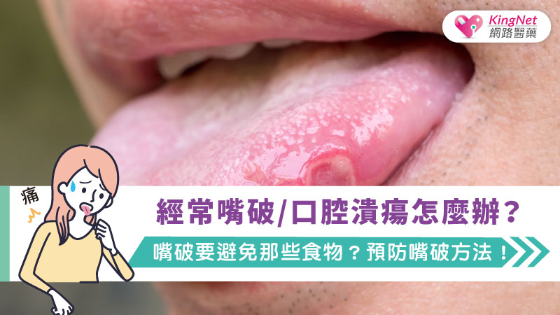  經常嘴破/口腔潰瘍怎麼辦？嘴破要避免那些食物？預防嘴破方法！_圖1