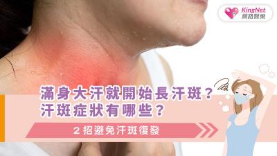 滿身大汗就開始長汗斑？汗斑症狀有哪些？２招避免汗斑復發