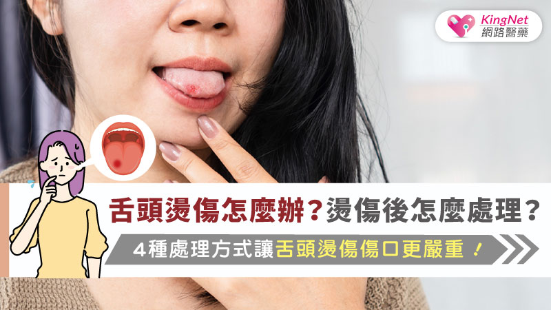 舌頭燙傷怎麼辦？燙傷後怎麼處理？4種處理方式讓舌頭燙傷傷口更嚴重！_圖1