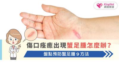 傷口痊癒出現蟹足腫怎麼辦？盤點預防蟹足腫９方法