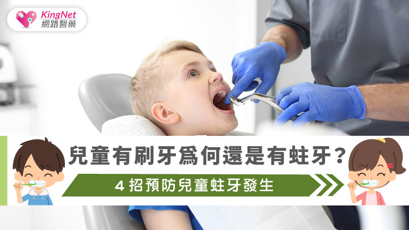 兒童有刷牙為何還是有蛀牙？４招預防兒童蛀牙發生_圖1