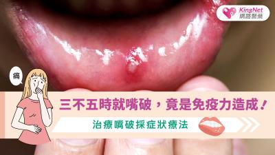 三不五時就嘴破，竟是免疫力造成！治療嘴破採症狀療法