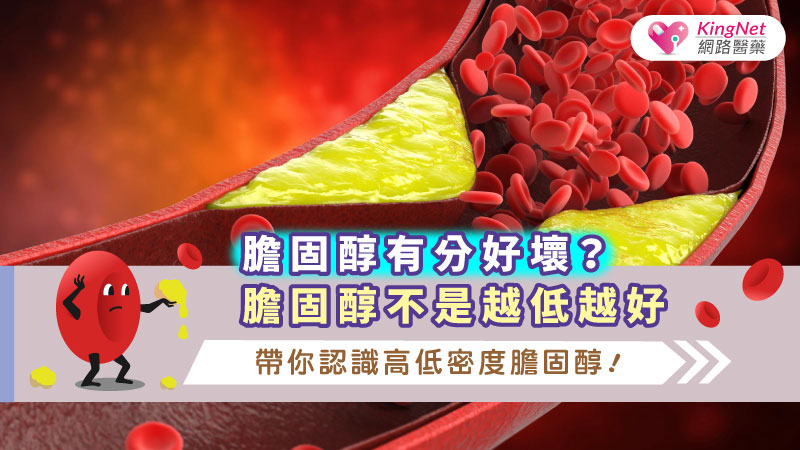 膽固醇有分好壞 ? 膽固醇不是越低越好，帶你認識高低密度膽固醇 !_圖1