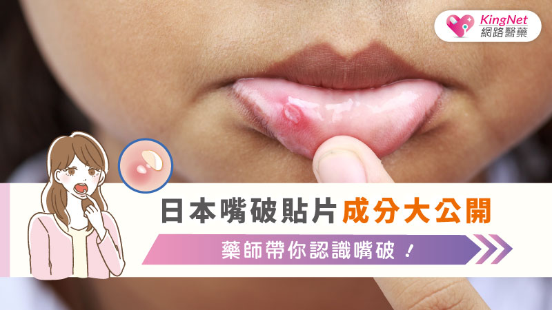 日本嘴破貼片成分大公開，藥師帶你認識嘴破！_圖1