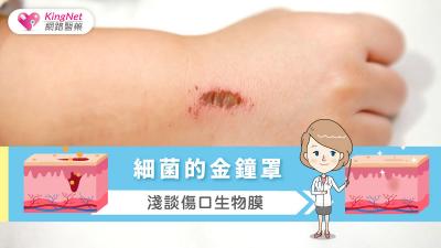 細菌的金鐘罩，淺談傷口生物膜