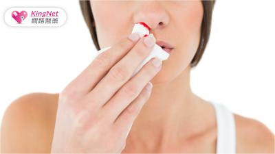 流鼻血頭要往後仰、還是向前頃？