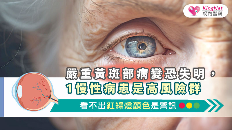 嚴重黃斑部病變恐失明，1慢性病患是高風險群，看不出紅綠燈顏色是警訊_圖1