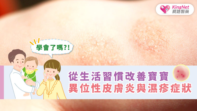從生活習慣改善寶寶異位性皮膚炎與濕疹症狀_圖1