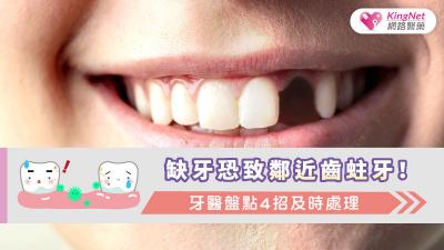 缺牙恐致鄰近齒蛀牙！牙醫盤點4招及時處理