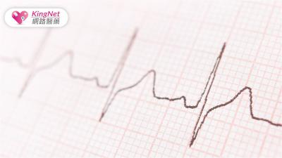 心房顫動全解析：識別、治療與生活調整的關鍵策略