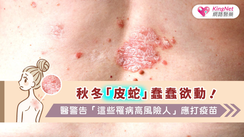 秋冬「皮蛇」蠢蠢欲動！　醫警告「這些罹病高風險人」應打疫苗_圖1