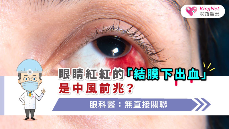 眼睛紅紅的「結膜下出血」是中風前兆？ 眼科醫：無直接關聯_圖1