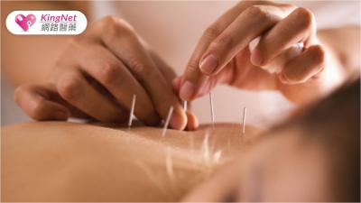 針灸能治療哪些病症？就連「呼吸問題、腸胃調節、眼疾、瘦身」都可以