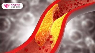 預防膽固醇失控關鍵，3方法調控飲食，包括吃好油、膳食纖維，但別碰這1物